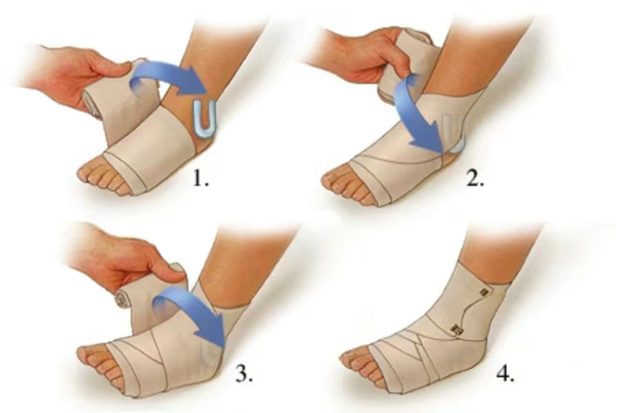 Guida al primo soccorso per infortuni al piede